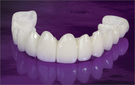 dentalna protetika